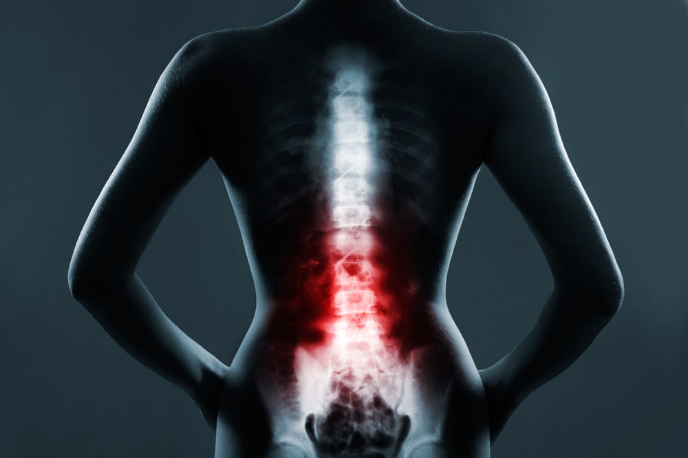 personal injury lawyer Essex County, NJ
